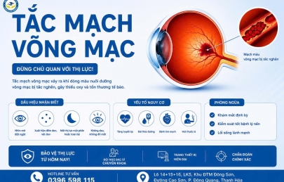 TẮC MẠCH VÕNG MẠC (ĐỘT QUỴ MẮT): NGUYÊN NHÂN, DẤU HIỆU VÀ CẤP CỨU Y KHOA KỊP THỜI